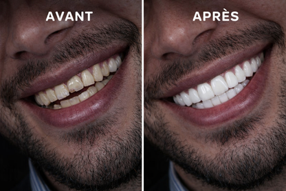 🦷 Dentifrice Original BodyAccel Blanchissant à la Niacinamide