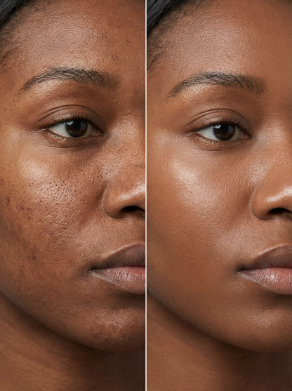 🧴 Sérum Anua original 10+ Niacinamide & TXA – Votre peau plus lumineuse en 7 jours