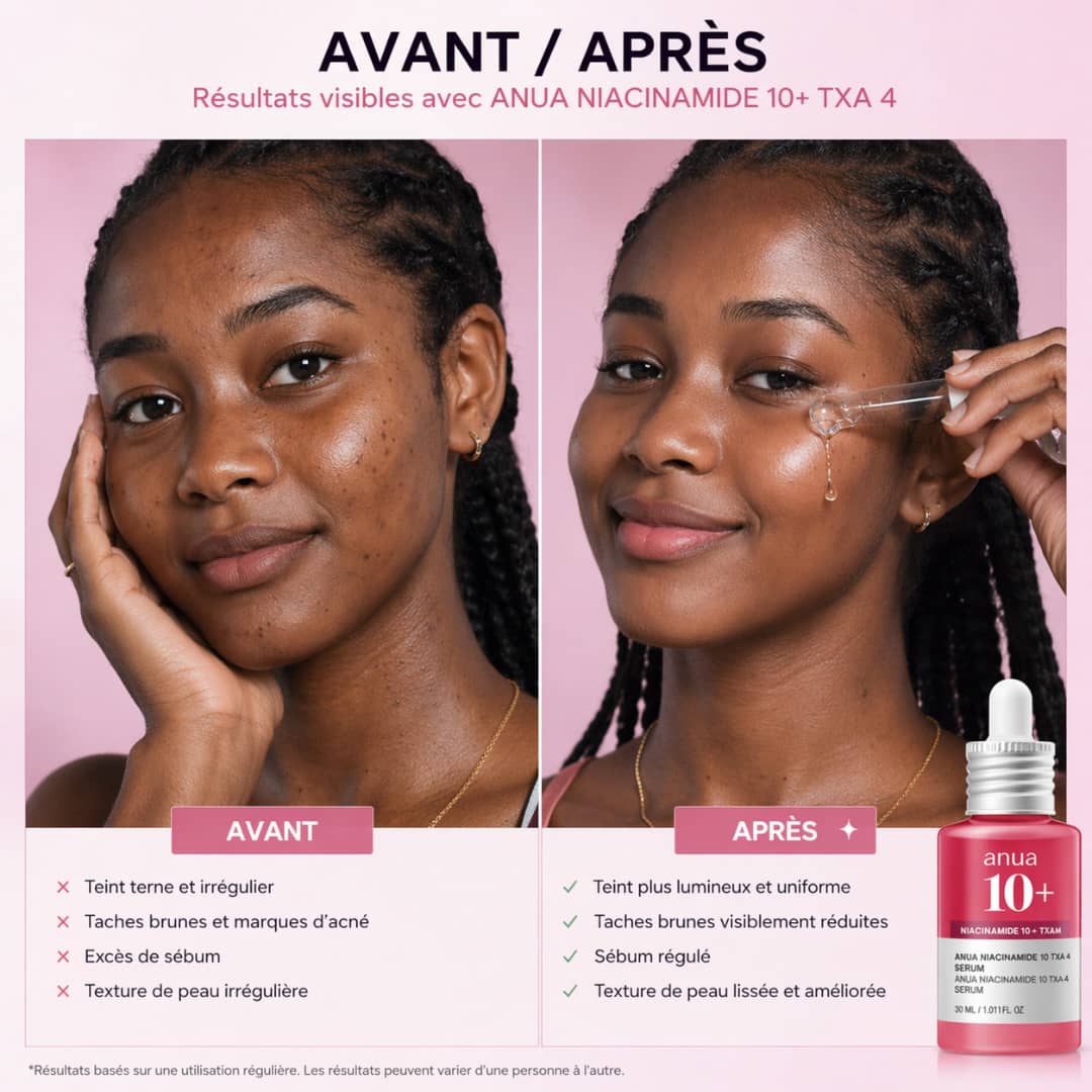 🧴 Sérum Anua original 10+ Niacinamide & TXA – Votre peau plus lumineuse en 7 jours