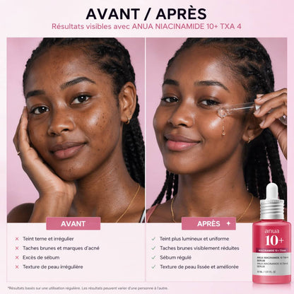 🧴 Sérum Anua original 10+ Niacinamide & TXA – Votre peau plus lumineuse en 7 jours
